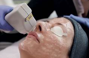 Soin rougeurs capilaires image